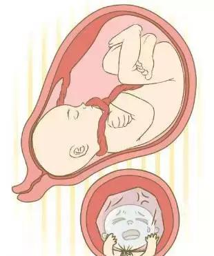 孕期须知：哪些异常胎动需要密切留意？