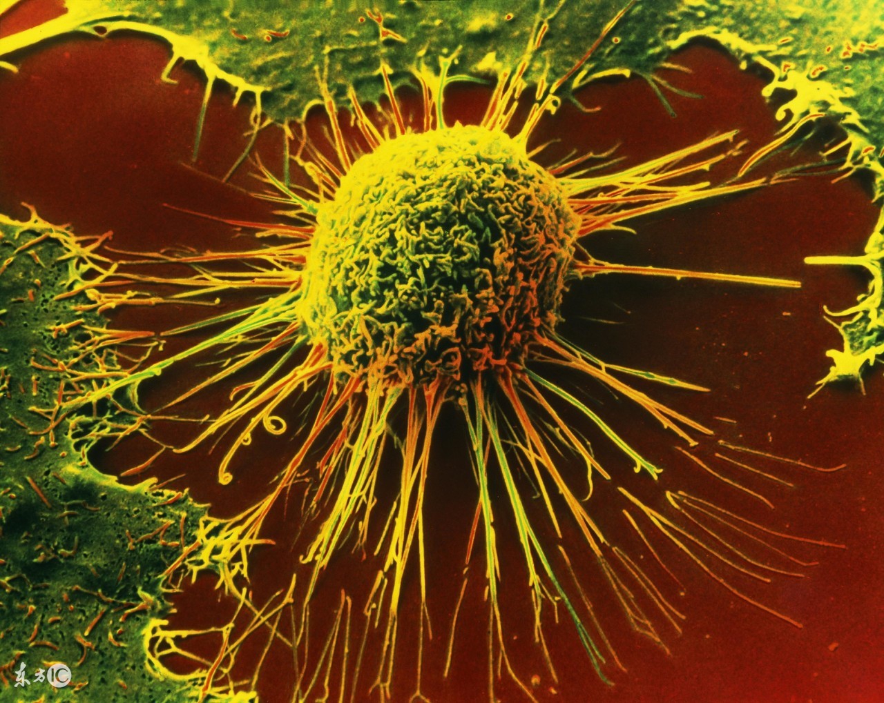 肿瘤专家谈宫颈癌,医院提醒大家关注宫颈癌健康