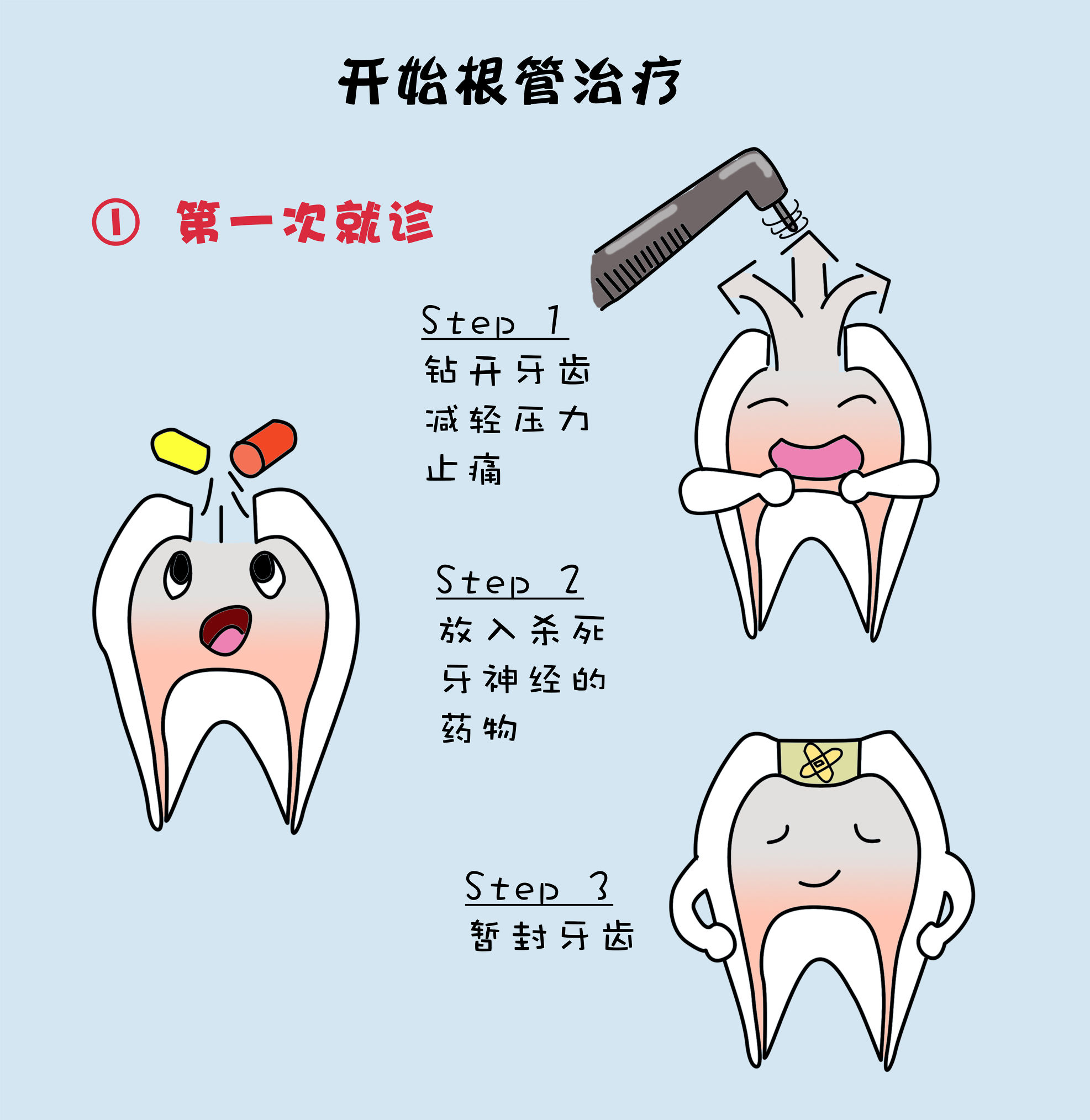 根管治疗是什么作用,根管治疗是什么情况下要做