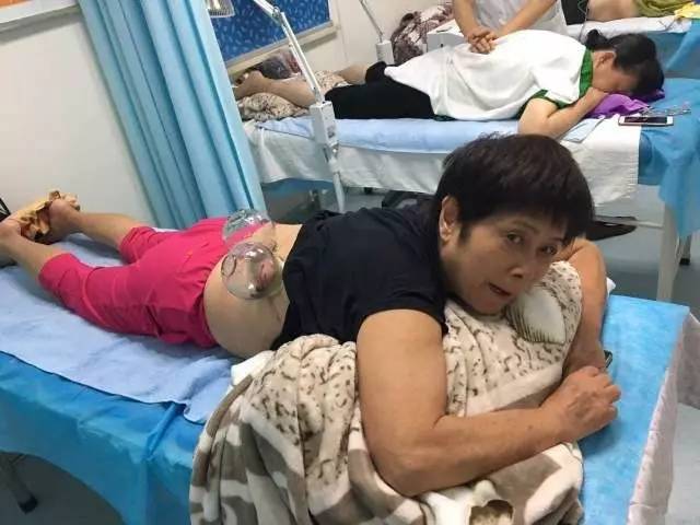 带状疱疹中医拔罐放血疗法有用吗,带状疱疹拔罐放血疗法的原理