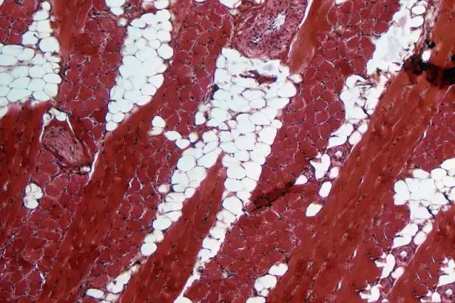 饮食拯救生命—连载之六——糖尿病（上）