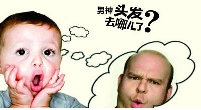 父亲脱发儿子脱发几率,父辈脱发一定会遗传吗