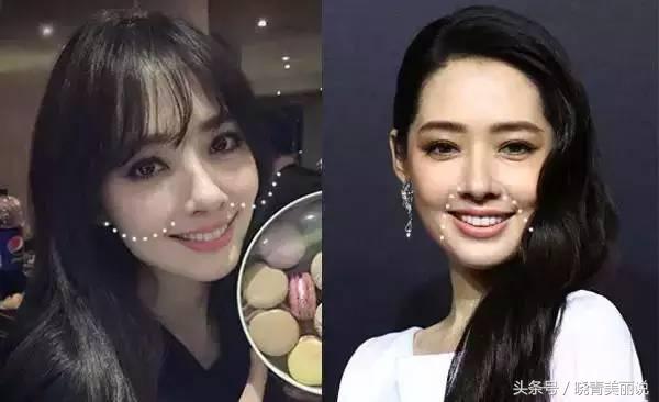 孩子刚出生就有法令纹,15岁小孩为啥有法令纹