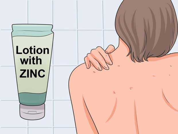 Freepure菲朴:背上长痘痘怎么办?7大杀招全解决