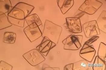 孕妇尿结晶数值多少是结石,尿结晶数量高看什么科