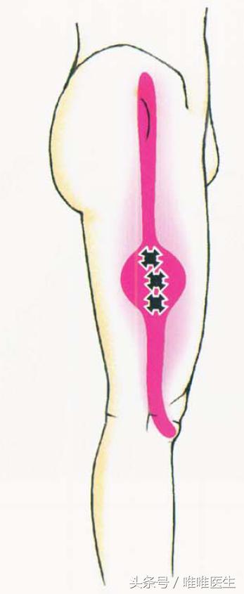 膝关节科普文章,膝关节疼痛最全解析