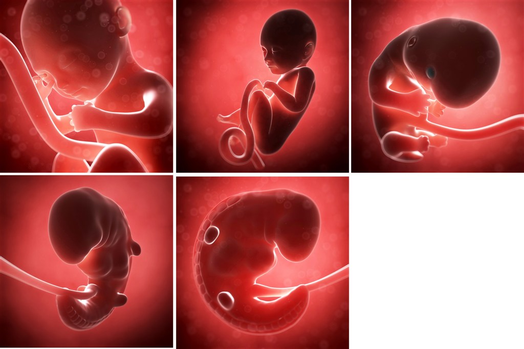 股骨长能辨别胎儿性格吗,股骨短胎儿会畸形吗