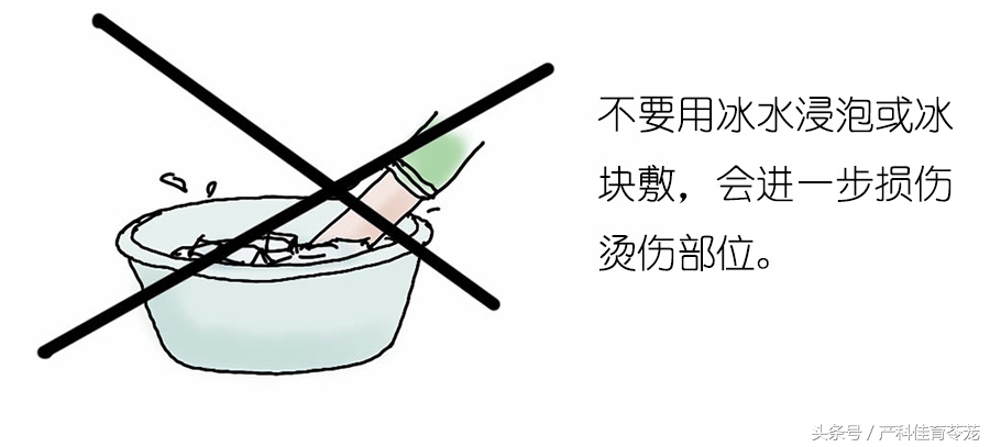 烫伤感染化脓在家怎样处理,烫伤皮掉了怎么处理好得快