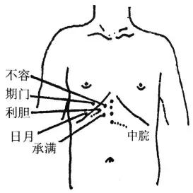 高手用针灸，有趣又有料