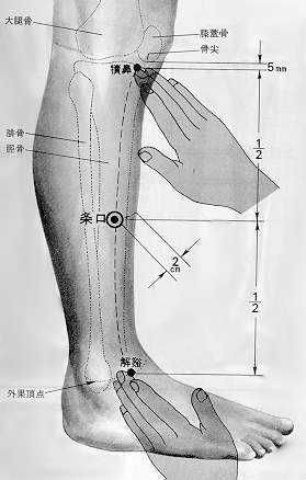 中医治疗疼痛的针灸方法,针灸治疗各种疼痛的穴位