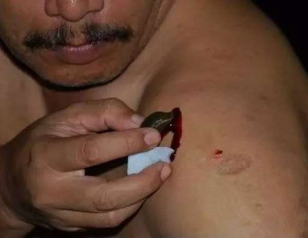 如果让水蛭吸饱血会怎么样,水蛭吸到我们身上会有什么反应