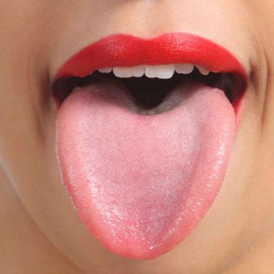 舌头有点皱证明什么,舌头边缘褶皱是什么原因