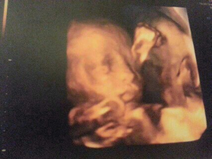 顺产宝妈要经历多少崩溃时刻,坚强妈妈强忍泪水分享孩子遭遇