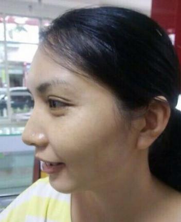 妈妈为女儿消脸上疤,妈妈为了孩子不容易