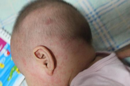 怎样纠正宝宝头睡偏,两个月宝宝头型睡扁了怎么调整