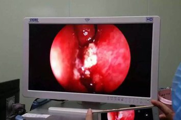 小孩鼻子上面头疼是什么原因,孩子鼻子不通头疼怎么回事