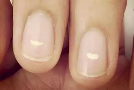 指甲上的月牙预示着什么,指甲上的月牙真的和健康有关系吗