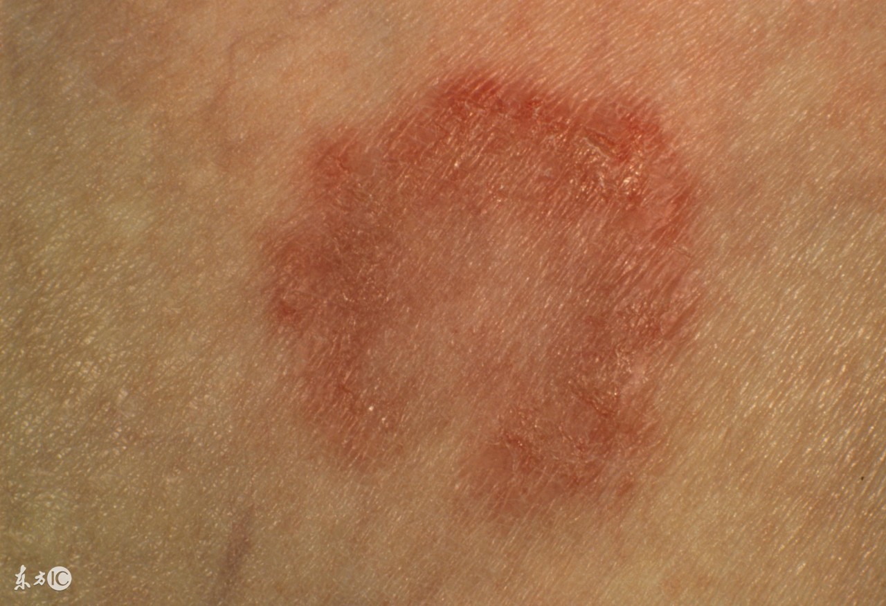 下雨天香港医院,下雨天香港脚能治好吗