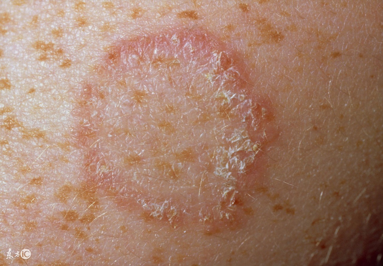 下雨天香港医院,下雨天香港脚能治好吗