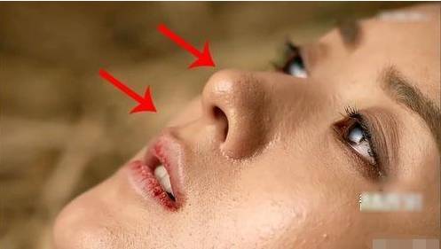 粉刺黑头去除最快方法,鼻子螨虫黑头怎么去除简单方法