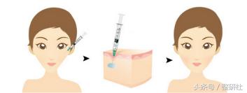 神奇逆龄线,神奇面部驻颜术