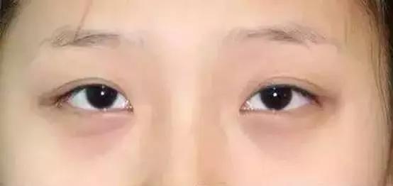 美瞳线和眼线哪个更漂亮一些,美瞳线加宽和画眼线的区别