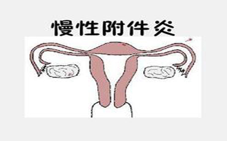 附件炎有什么影响,附件炎是因为什么而产生的呢