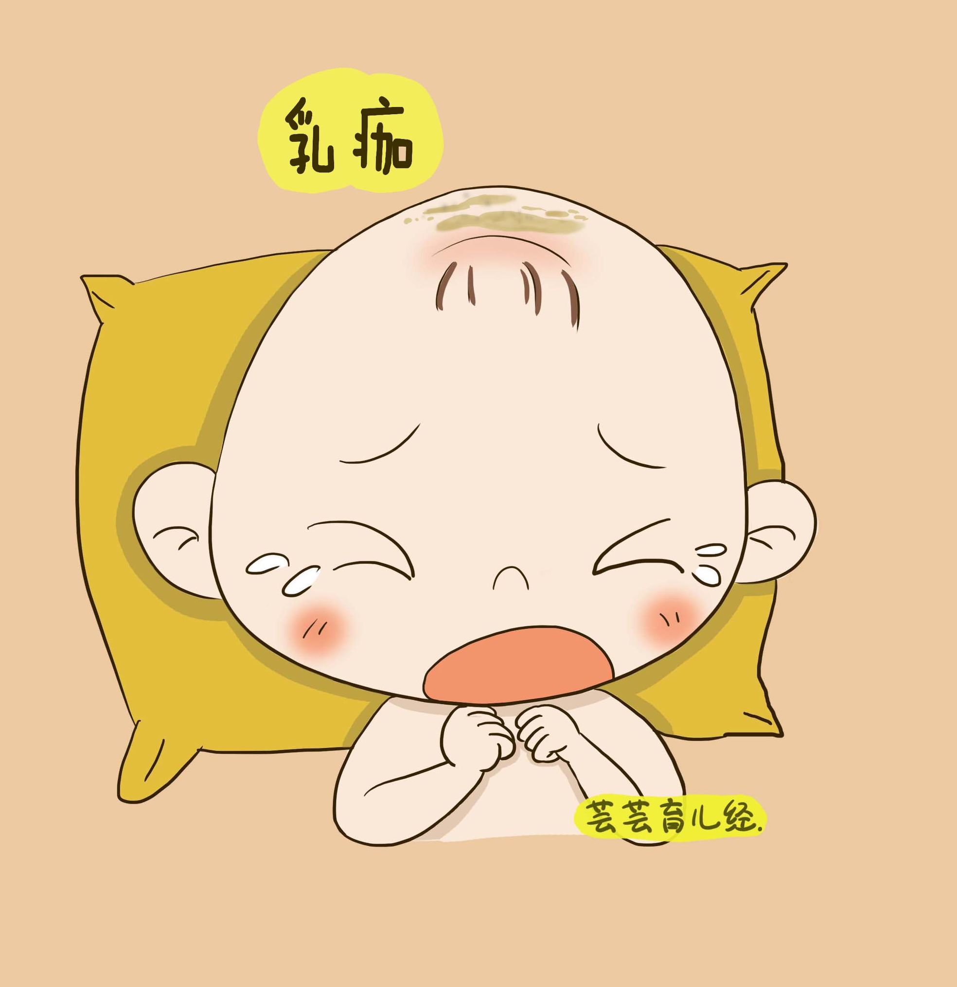 宝宝乳痂很顽固该如何科学清洗,新生儿乳痂怎么清洗