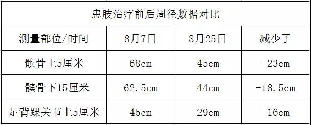 淋巴水肿皮肤发硬怎么治疗,淋巴水肿患者的早期症状