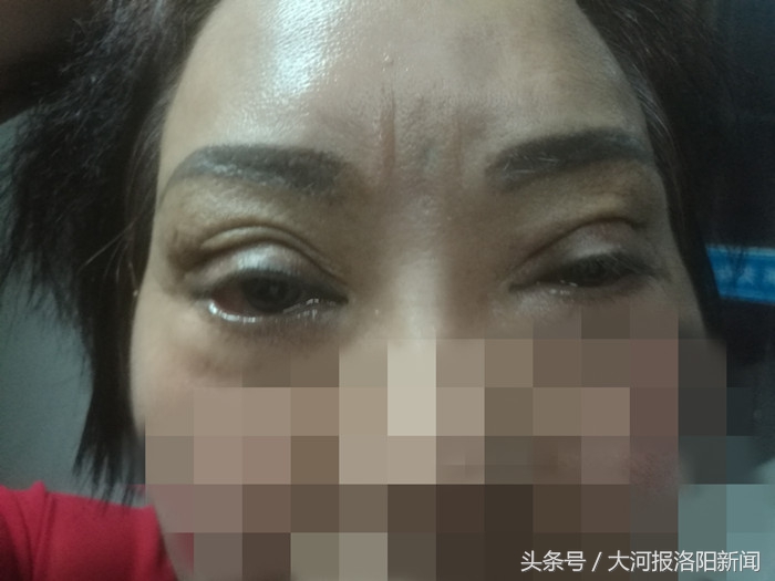 整形有风险需要谨慎,整形有风险能不整就不整