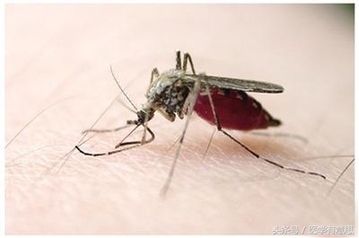 孕妇隐翅虫叮咬后皮肤溃烂,隐翅虫叮过后用蚊虫叮咬膏有效吗