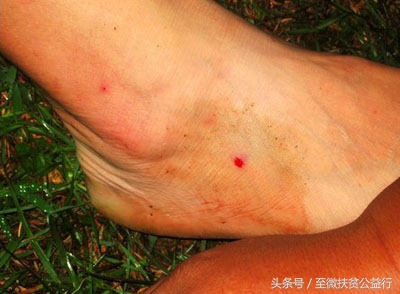 农村动物界的“四大天王”!招惹它们定会让你痛不欲生!