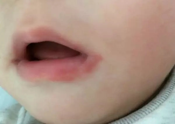 孩子逃避吃饭怎么办,孩子实在不想吃饭