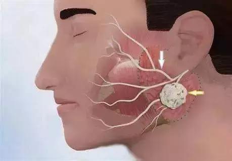 眼眉跳预兆是真的吗,眼眉跳是吉兆吗