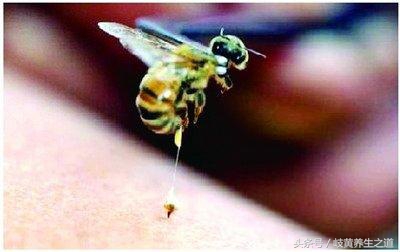 对蜂针免疫的人,蜂针治好后会死吗