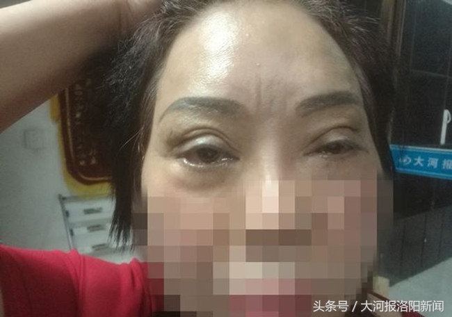 美容变毁容恢复后可以要求赔吗,美容变毁容医院还治疗回来吗