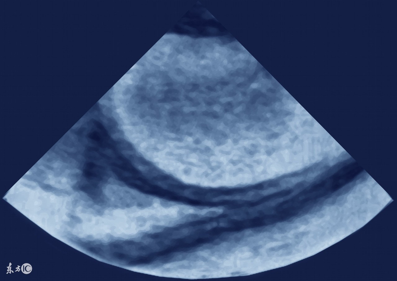 哪些病会导致肚子腹水,什么样的癌症肚子里有水