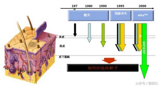 光电祛疤效果图,光电祛斑拯救麻子脸