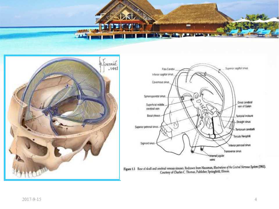 颅内静脉窦血栓形成怎么治疗,颅内静脉窦血栓形成最佳治疗方法