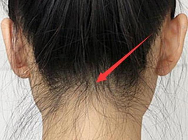 女孩头发毛躁碎发多炸毛怎么养护,女生头顶碎发多炸毛怎么处理