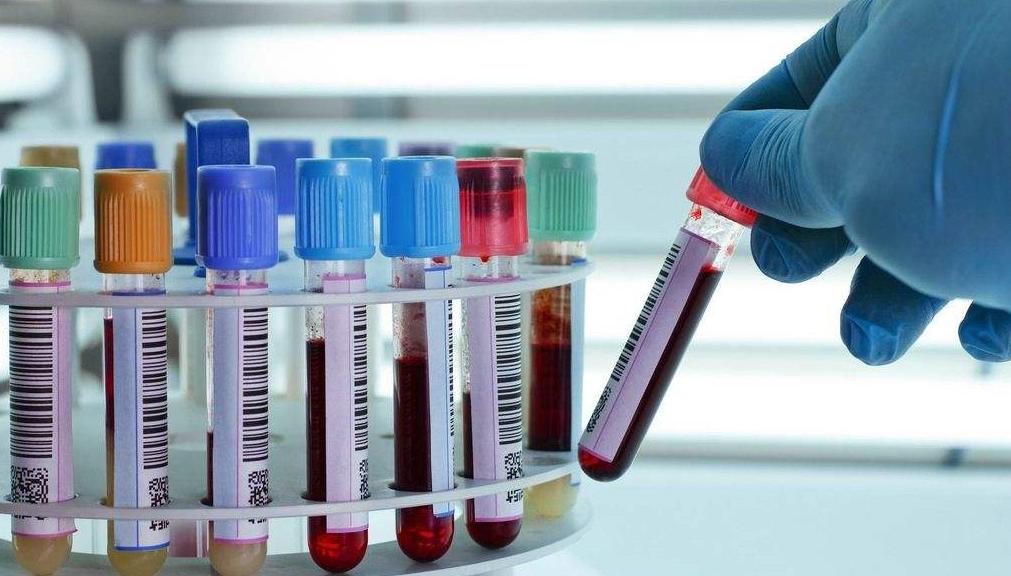 丙肝患者吃哪种抗病毒药物,丙肝抗病毒服药期间有何禁忌