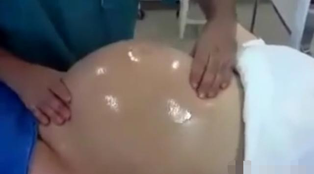 胎位不正胎儿的姿势,胎儿胎位不正怎么转过来