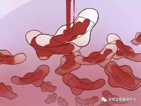 29岁女子子宫里长110颗肌瘤，长了这么多都没发现，竟是……