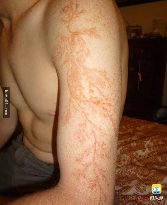 被雷劈是种什么样的体验？看完简直身受同感