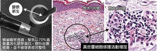 专家推荐祛痘方法,医生推荐祛痘痕痘印最有效的办法