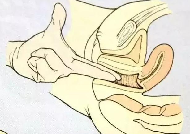 开宫指是医生手开吗,宫开十指是指子宫还是什么