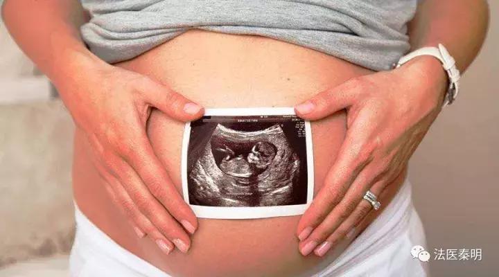 顺产与剖宫产如何选择,顺产vs剖宫产到底哪个好