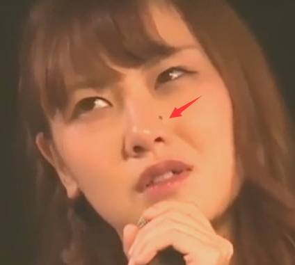 痣解析女面部,女性痣的全面解释视频