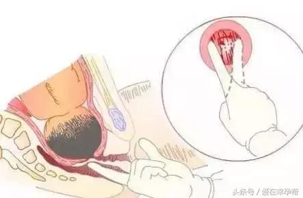 为什么内检大夫是男的,内检会遇到男医生吗