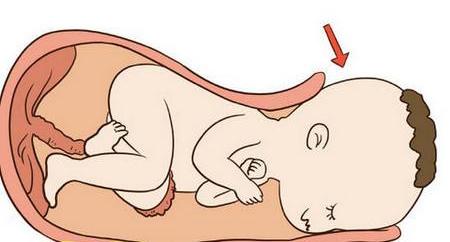 自然分娩时可怕吗？到底有多痛？